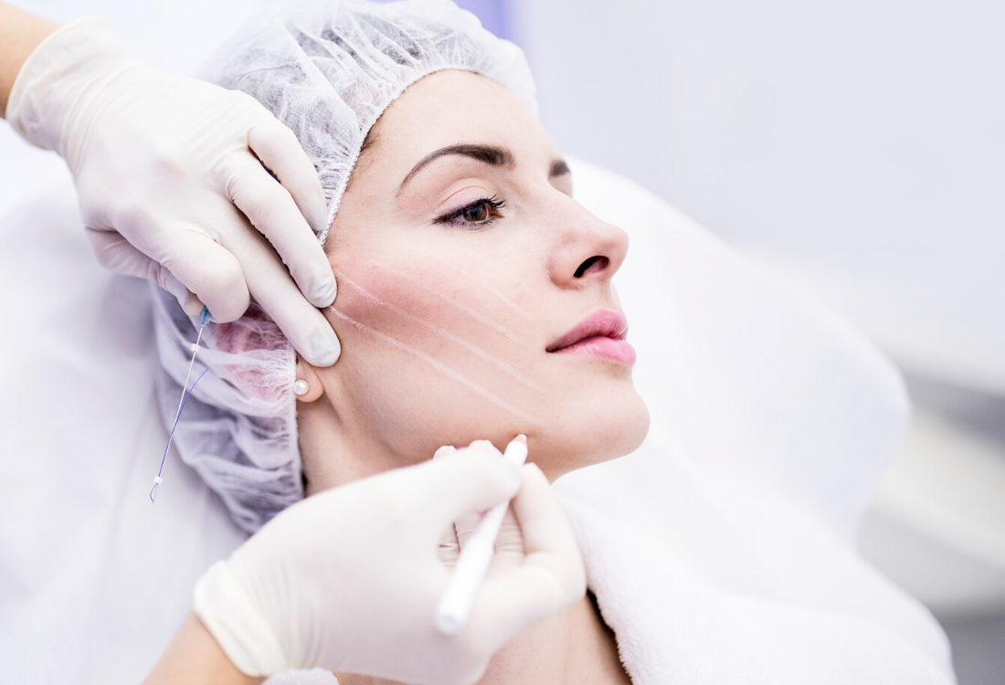 Thread Lift Face